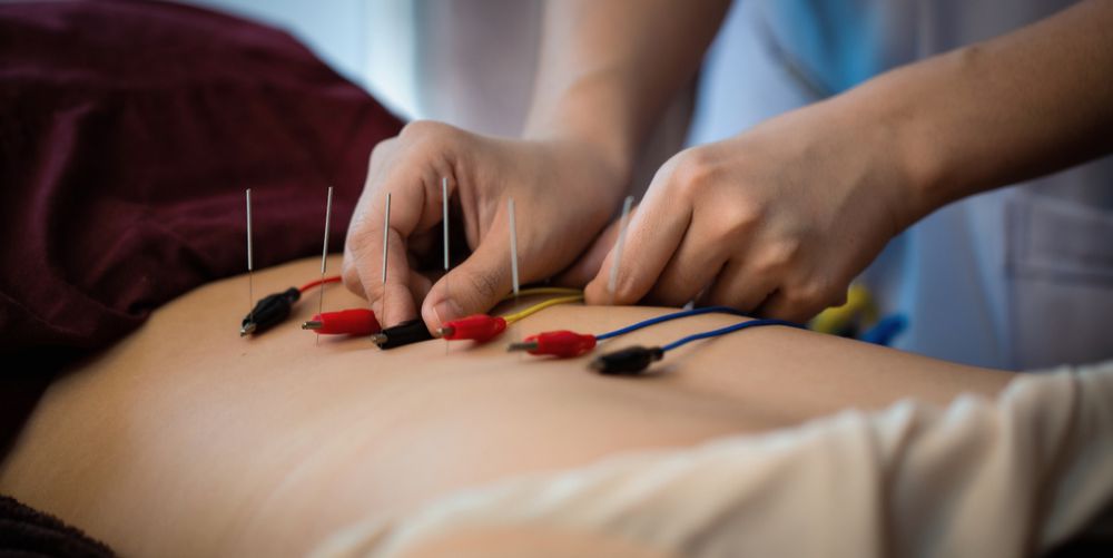 The Acupuncture Therapy